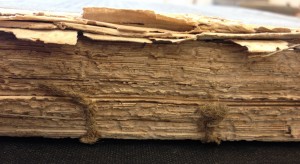 "Dr. Rees’s New Cyclopaedia" Spine Before Treatment